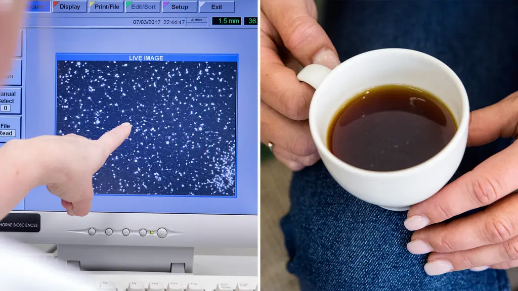 Mikroskopbild som visar färgade spermier i blått på en vit bakgrund, tagna i ett laboratorium för forskning om embryon skapade från hudceller.