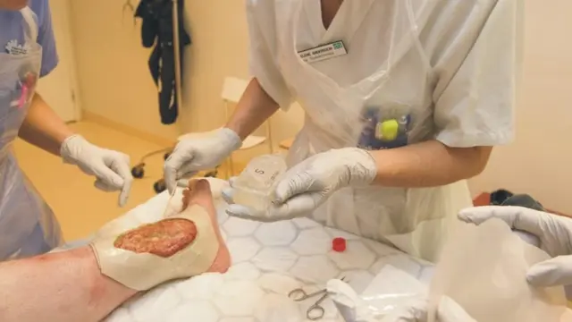 Helene Andersson-Forsström utövar så kallad larvterapi med hjälp av fluglarver i sår. 