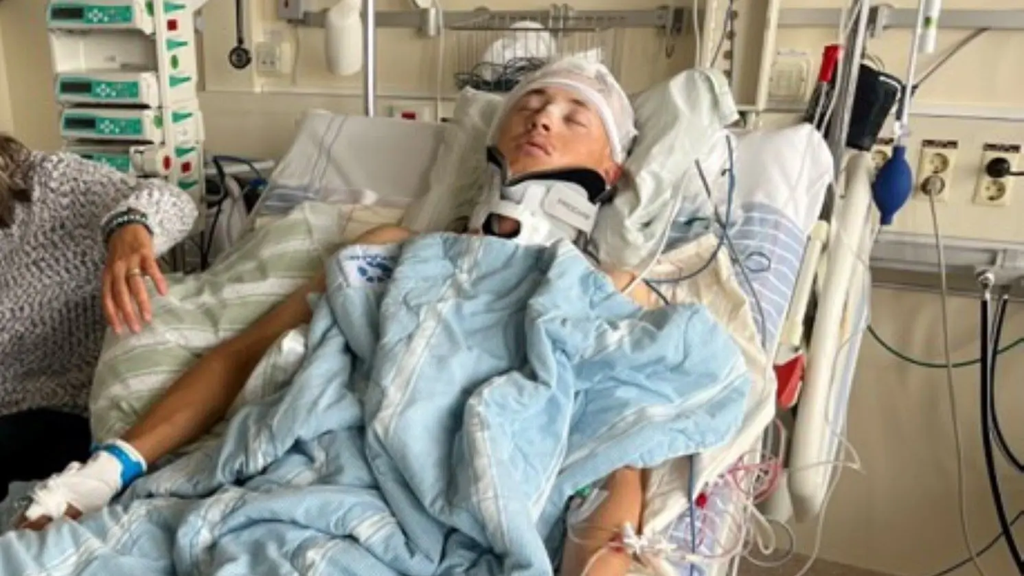 Rasmus Seppänen fick en 250 kilo tung belysningsmast över sig på festivalen Summer On och återhämtningen har varit lång.