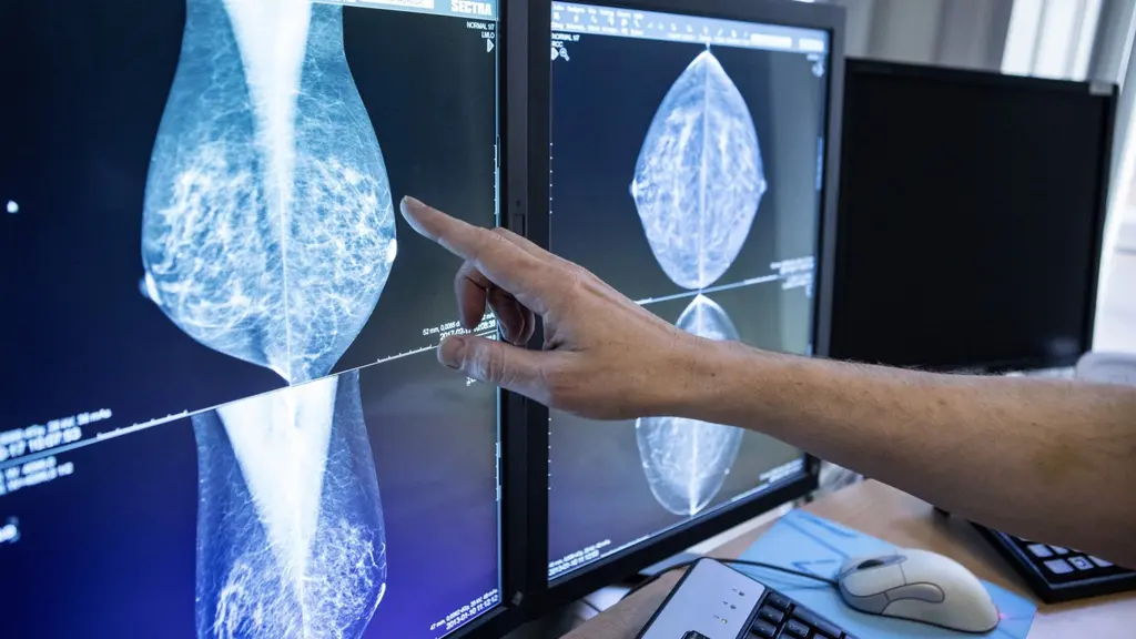 Läkare tittar på mammografibilder