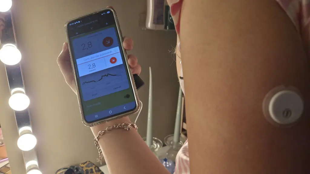 More young people in Sweden are getting type 2 diabetes