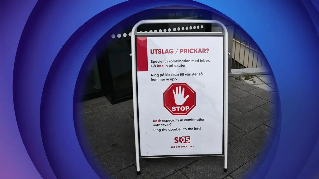 Measles outbreak spreading in Sweden – this is what you need to know