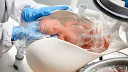 I Nederländerna jobbar forskare intensivt för att kunna skapa konstgjorda livmödrar. Här testar de med en docka som förs över från ett kejsarsnitt.