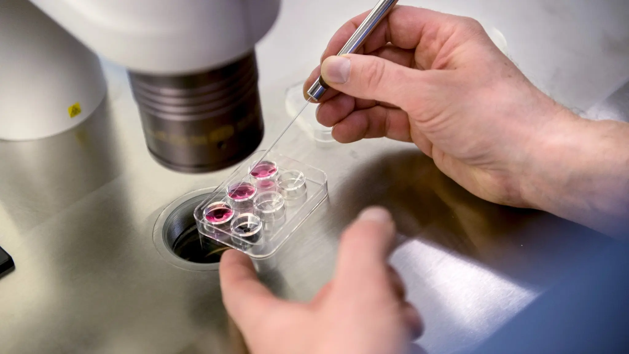 Närbild på händer som arbetar med laboratorieutrustning vid en fertilitetsklinik i Stockholm. En pipett används för att hantera obefruktade ägg i en behållare under ett mikroskop.