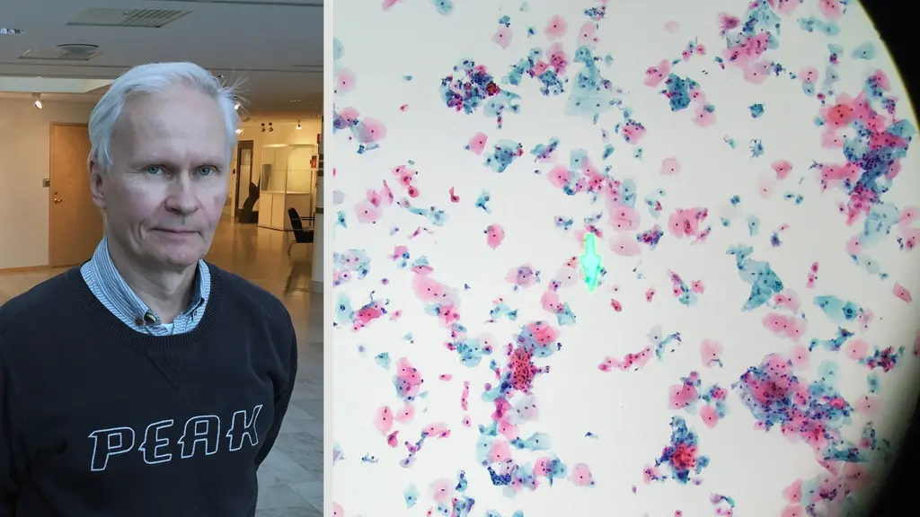 Staffan Lundberg och en bild på ett cellprov.