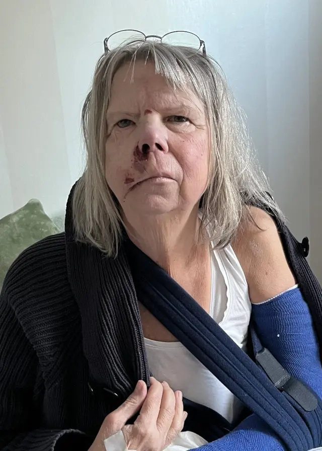 En person sitter på en säng med en blå gipsad arm i mitella. Bakom personen syns kuddar och en vit vägg. Bilden förmedlar en känsla av återhämtning efter en skada.