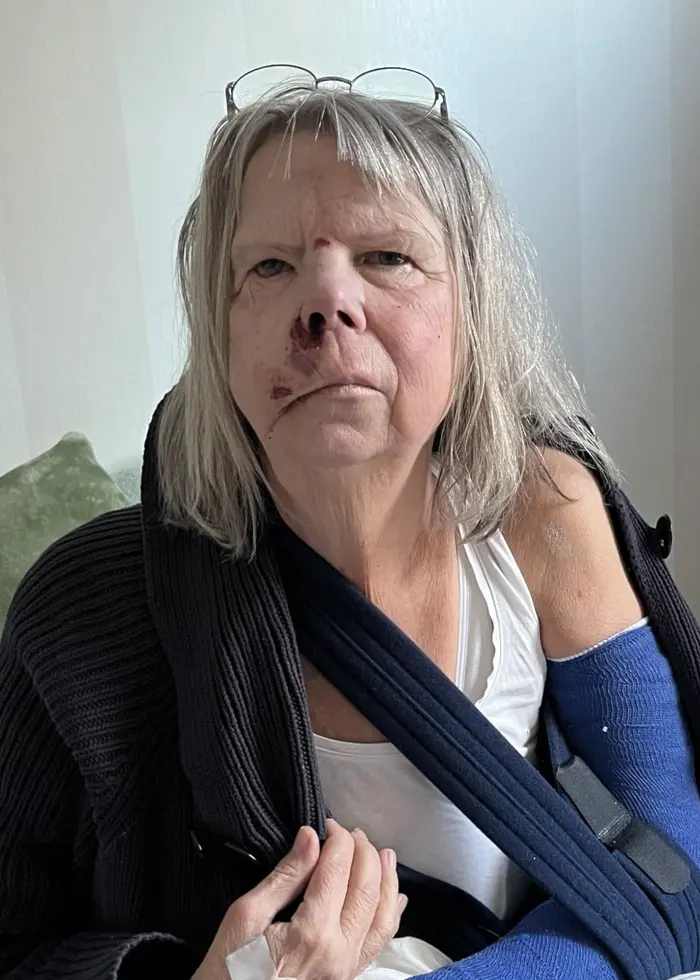 En person sitter på en säng med en blå gipsad arm i mitella. Bakom personen syns kuddar och en vit vägg. Bilden förmedlar en känsla av återhämtning efter en skada.